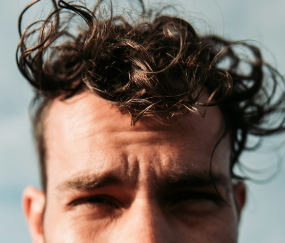 АЛОПЕЦІЯ: ЯК ЛІКУВАТИ ПАТОЛОГІЧНЕ ВИПАДІННЯ ВОЛОССЯ?