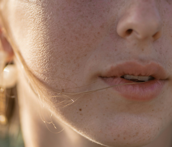 ЧЕРВОНІ ПЛЯМИ НА ОБЛИЧЧІ (РОЗАЦЕА): ПРИЧИНИ, ПРОФІЛАКТИКА ТА ЛІКУВАННЯ