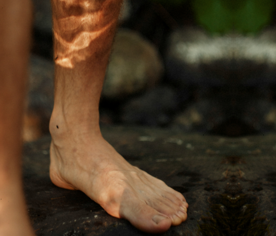 ФЛЕБІТ: ПРИЧИНИ ТА СИМПТОМИ, ЛІКУВАННЯ ТА ПРОФІЛАКТИКА