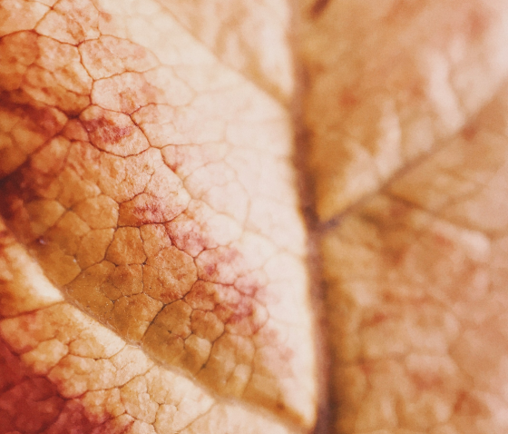 ЕКЗЕМА: ПРИЧИНИ, СИМПТОМИ, ЛІКУВАННЯ