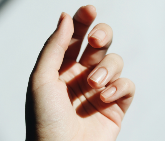 ПАНАРИЦІЙ: ПРИЧИНИ, СИМПТОМИ, ДІАГНОСТИКА ТА ЛІКУВАННЯ