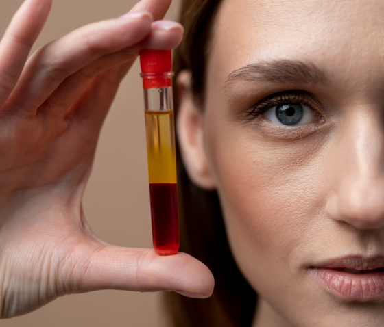 ПЛАЗМОЛИФТИНГ (PRP-ТЕРАПИЯ): ПРЕИМУЩЕСТВА, НЕДОСТАТКИ И РЕАЛЬНАЯ ЭФФЕКТИВНОСТЬ ПРОЦЕДУРЫ